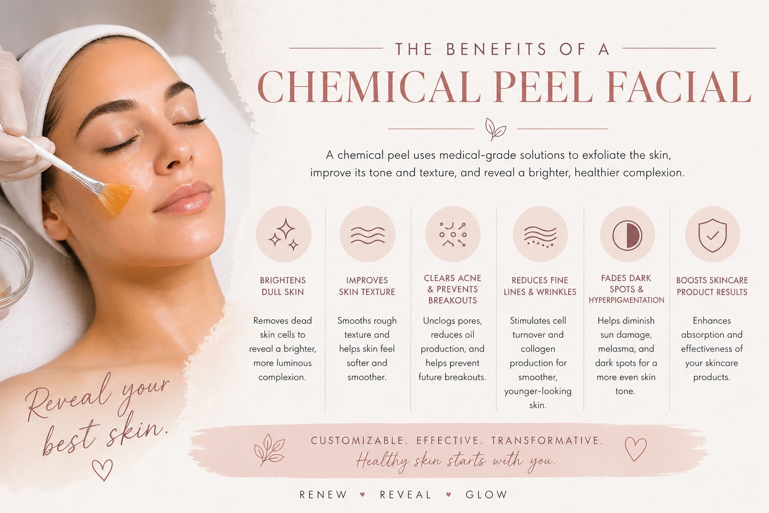 Chemical Peel Benefits