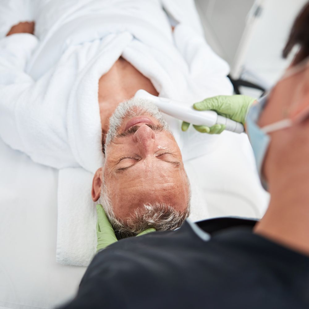 Photofacial IPL