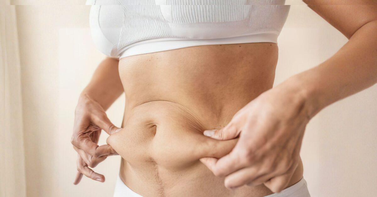 Skin Tightening After GLP-1