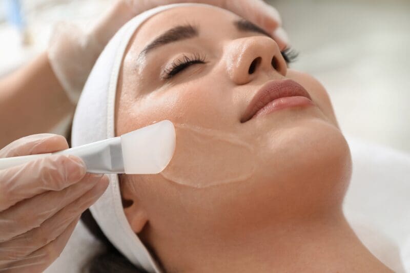 Chemical peel facial at a skincare clinic