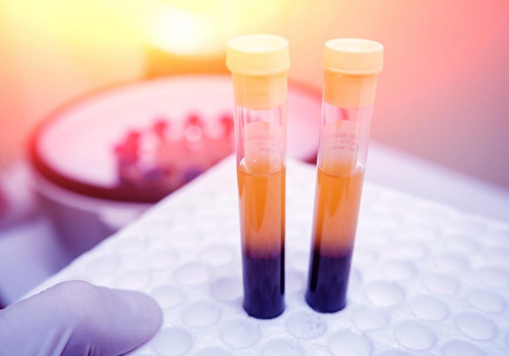Medical samples in laboratory setting